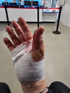 PIcture of a hand wrapped in a bloody bandage against the white and grey background of a casualty department floor and wall. 