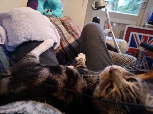 Picture of tabby cat lying on the legs of a person reclining on a sofa with a towel (containing an ice pack) on one knee. In the background a window, a door and one crutch.